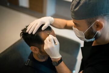 Everything You Need to Know About Hair Transplant in London, UK